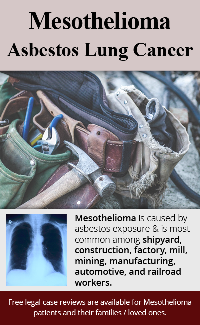 Mesothelioma is caused by asbestos exposure & is most common among shipyard, construction, factory, mill, mining, manufacturing, automotive, and railroad workers. // Monroe Law Group